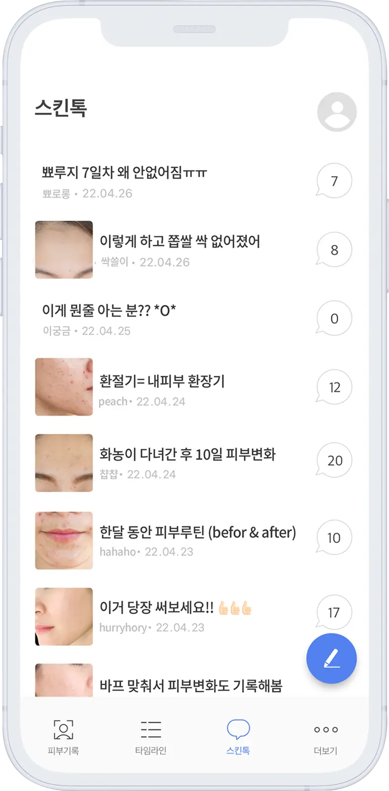 고민이 있다면
스킨톡에